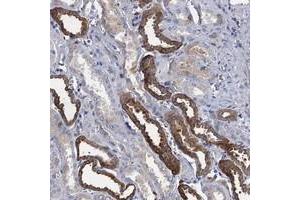 Immunohistochemical staining of human kidney with TMEM72 polyclonal antibody  shows strong cytoplasmic positivity in tubular cells at 1:200-1:500 dilution. (TMEM72 anticorps)