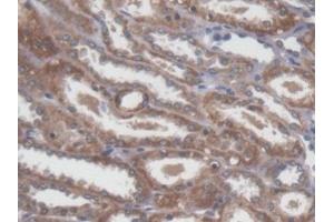 Detection of NME5 in Human Kidney Tissue using Polyclonal Antibody to Non Metastatic Cells 5, Protein NM23A Expressed In (NME5) (NME5 anticorps  (AA 3-194))