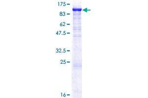 Image no. 1 for Zona Pellucida Glycoprotein 2 (ZP2) (AA 1-736) protein (GST tag) (ABIN1326501)
