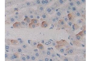 Detection of MAP4 in Rat Liver Tissue using Polyclonal Antibody to Microtubule Associated Protein 4 (MAP4)