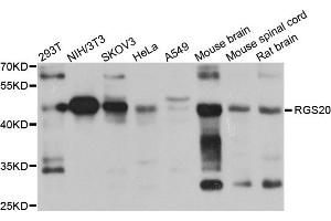 Western blot analysis of extracts of various cell lines, using RGS20 antibody (ABIN5974507) at 1/1000 dilution.