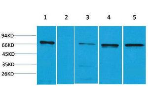 Western Blotting (WB) image for anti-Zinc Finger and BTB Domain Containing 45 (ZBTB45) antibody (ABIN3179016) (ZBTB45 anticorps)