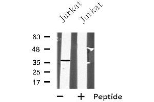 Western blot analysis of PPP2CA using Jurkat whole cell lysates (PPP2CA anticorps  (C-Term))