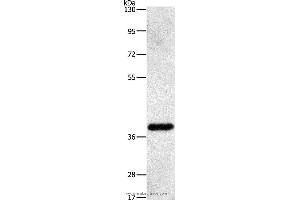 Western blot analysis of Human fetal liver tissue, using PRKAG1 Polyclonal Antibody at dilution of 1:500 (PRKAG1 anticorps)