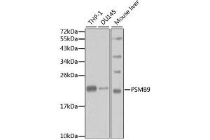 Western blot analysis of extracts of various cell lines, using PSMB9 antibody. (PSMB9 anticorps)