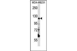 Western blot analysis of PITRM1 Antibody (Center) in MDA-MB231 cell line lysates (35ug/lane). (PITRM1 anticorps  (Middle Region))