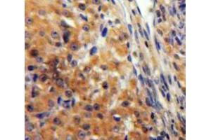 IHC-P analysis of Ovary tissue, with DAB staining. (KNG1 anticorps  (AA 390-644))