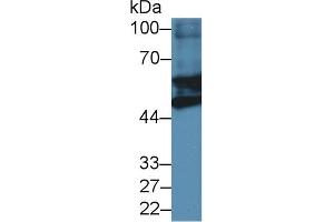 Detection of GFAP in Mouse Heart lysate using Polyclonal Antibody to Glial Fibrillary Acidic Protein (GFAP) (GFAP anticorps  (AA 253-354))