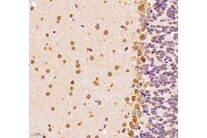 Immunohistochemistry of paraffin embedded mouse epencephalon using UQCC (ABIN7076094) at dilution of 1: 1000 (400x lens)