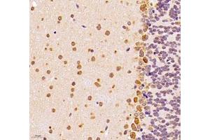 Immunohistochemistry of paraffin embedded mouse epencephalon using UQCC (ABIN7076094) at dilution of 1: 1000 (400x lens) (Ubiquinol-Cytochrome C Reductase Complex Chaperone (UQCC) anticorps)