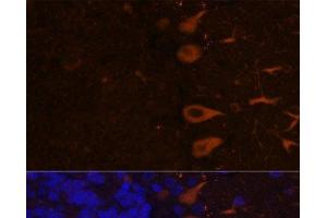 Immunofluorescence analysis of Rat brain using KAL1 Polyclonal Antibody at dilution of 1:100. (KAL1 anticorps)