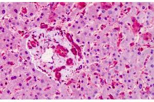 Human Liver: Formalin-Fixed, Paraffin-Embedded (FFPE) (SMO anticorps  (AA 68-117))