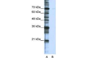 WB Suggested Anti-CSTF2T Antibody Titration:  0.