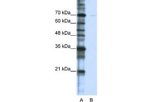 WB Suggested Anti-CSTF2T Antibody Titration:  0. (CSTF2T anticorps  (C-Term))