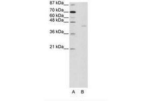 Image no. 1 for anti-PiggyBac Transposable Element Derived 1 (PGBD1) (AA 721-770) antibody (ABIN202922) (PGBD1 anticorps  (AA 721-770))