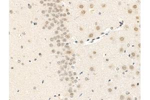 ABIN7094823 and ABIN7098874 at 1/100 staining Rat brain tissue by IHC-P.