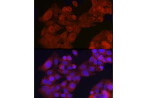 Immunofluorescence analysis of HepG2 cells using GFR Rabbit pAb (ABIN6127950, ABIN6141065, ABIN6141066 and ABIN6221017) at dilution of 1:200 (40x lens).