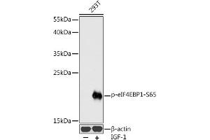 Western blot analysis of extracts of 293T cells, using Phospho-eIF4EBP1-S65 antibody (ABIN3023531, ABIN3023532, ABIN3023533 and ABIN6225390) at 1:1000 dilution. (eIF4EBP1 anticorps  (pSer65))