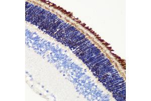 Immunohistochemistry of paraffin-embedded mouse retina using PDE6B antibody (ABIN6132473, ABIN6145363, ABIN6145364 and ABIN6222688) at dilution of 1:200 (40x lens). (PDE6B anticorps  (AA 1-190))