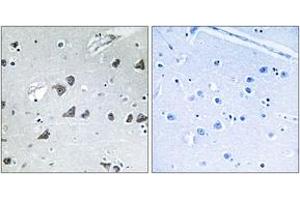 Immunohistochemistry analysis of paraffin-embedded human brain tissue, using EIF3F Antibody.