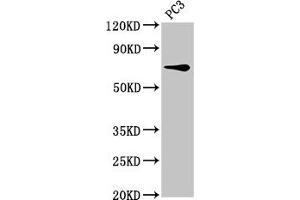 Western Blot Positive WB detected in: PC-3 whole cell lysate All lanes: SCNN1B antibody at 8 μg/mL Secondary Goat polyclonal to rabbit IgG at 1/50000 dilution Predicted band size: 73, 78 kDa Observed band size: 73 kDa