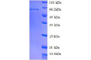 Keratin 8 (KRT8) (AA 2-483), (full length) protein (His tag) (KRT8 Protein (AA 2-483, full length) (His-SUMO Tag))
