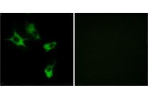 Immunofluorescence analysis of COS7 cells, using MAST4 Antibody. (MAST4 anticorps  (AA 251-300))