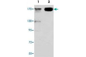 Western blot analysis of JARID1C monoclonal antibody  at 1:1000 dilution.