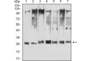 Western blot analysis using YWHAQ mouse mAb against Hela (1), NIH/3T3 (2), C6 (3), A549 (4), COS7 (5), PC-12 (6), and HEK293 (7) cell lysate. (14-3-3 theta anticorps  (AA 1-245))