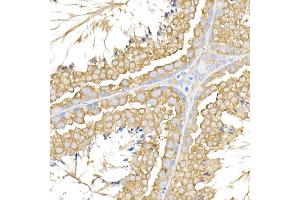 Immunohistochemistry of paraffin-embedded mouse testis using USP9Y Rabbit pAb (ABIN7271171) at dilution of 1:150 (40x lens). (USP9Y anticorps)