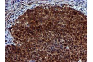 Image no. 12 for anti-Sepiapterin Reductase (SPR) antibody (ABIN1501115)