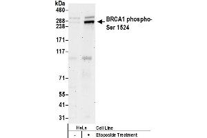 Western Blotting (WB) image for anti-Breast Cancer 1 (BRCA1) (pSer1524) antibody (ABIN7449280)