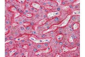 Human Liver: Formalin-Fixed, Paraffin-Embedded (FFPE) (SQSTM1 anticorps  (C-Term))