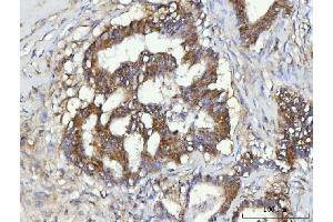 IHC analysis of CBR1 using anti-CBR1 antibody (ABIN7600015). (CBR1 anticorps  (AA 14-262))