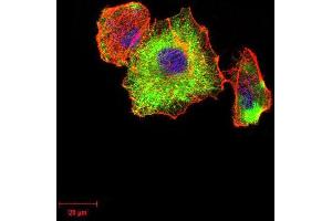 Immunofluorescence analysis of Hela cells using TUBB1 mouse mAb (green).