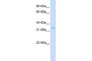 WB Suggested Anti-OTX2 Antibody Titration:  0. (OTX2 anticorps  (Middle Region))