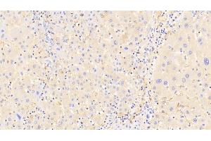 Detection of a2M in Human Liver Tissue using Polyclonal Antibody to Alpha-2-Macroglobulin (a2M) (alpha 2 Macroglobulin anticorps  (AA 616-856))