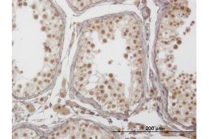 Immunoperoxidase of monoclonal antibody to PIM1 on formalin-fixed paraffin-embedded human testis. (PIM1 anticorps  (AA 1-100))