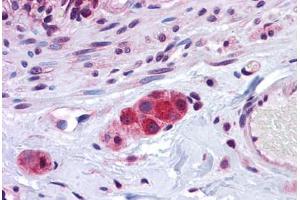 Human Small Intestine, Submucosal Plexus: Formalin-Fixed, Paraffin-Embedded (FFPE) (ZEB2 anticorps  (C-Term))