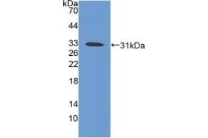 Detection of Recombinant iNV, Mouse using Polyclonal Antibody to Involucrin (INV)