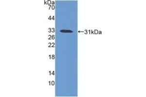 Detection of Recombinant iNV, Mouse using Polyclonal Antibody to Involucrin (INV) (Involucrin anticorps  (AA 301-460))