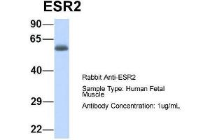 Host:  Rabbit  Target Name:  ESR2  Sample Type:  Human Fetal Muscle  Antibody Dilution:  1. (ESR2 anticorps  (N-Term))