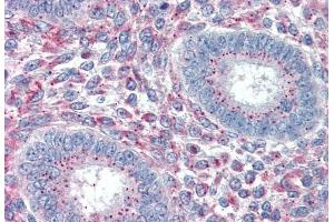 (ABIN238608) (5 μg/mL) staining of paraffin embedded Human Uterus.