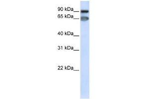 WB Suggested Anti-MED16 Antibody Titration: 0. (MED16 anticorps  (C-Term))