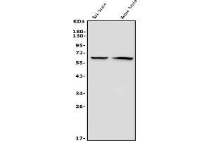 Western blot analysis of GAD65/GAD2 using anti-GAD65/GAD2 antibody (ABIN7603170).
