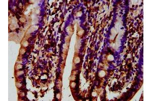 anti-Synaptojanin 1 (SYNJ1) (AA 1030-1261) antibody
