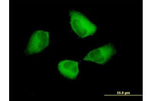 Immunofluorescence of purified MaxPab antibody to PDCD6IP on HeLa cell. (ALIX anticorps  (AA 1-868))