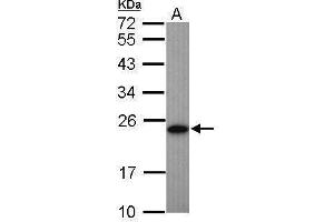 WB Image Sample (50 ug of whole cell lysate) A: Mouse brown adipose tissue 12% SDS PAGE antibody diluted at 1:1000