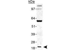 Western blot analysis of TMED10 in human liver lysate with TMED10 polyclonal antibody . (TMED10 anticorps  (AA 100-200))