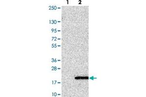 Western blot analysis of Lane 1: Negative control (vector only transfected HEK293T lysate). (UFSP1 anticorps)